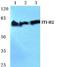 Inter-alpha-trypsin inhibitor heavy chain H2 antibody, A07196-1, Boster Biological Technology, Western Blot image 