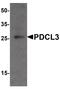 Phosducin Like 3 antibody, PA5-38046, Invitrogen Antibodies, Western Blot image 