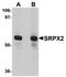 Sushi Repeat Containing Protein X-Linked 2 antibody, orb75306, Biorbyt, Western Blot image 