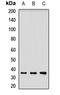 Laforin antibody, orb412522, Biorbyt, Western Blot image 