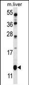 Golgi Transport 1B antibody, PA5-71780, Invitrogen Antibodies, Western Blot image 