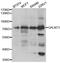 Polypeptide N-Acetylgalactosaminyltransferase 3 antibody, orb373432, Biorbyt, Western Blot image 