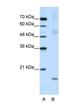 Nucleolar Pre-RRNA Processing Protein NIP7 antibody, NBP1-57435, Novus Biologicals, Western Blot image 