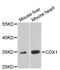 Homeobox protein CDX-1 antibody, STJ28280, St John