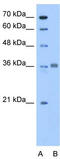 Aldolase, Fructose-Bisphosphate C antibody, TA346596, Origene, Western Blot image 