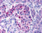 Inhibitor Of Nuclear Factor Kappa B Kinase Subunit Epsilon antibody, 2329, ProSci Inc, Immunohistochemistry paraffin image 
