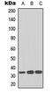 Cyclin Dependent Kinase 1 antibody, LS-C358947, Lifespan Biosciences, Western Blot image 