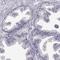 Sperm Associated Antigen 17 antibody, HPA028666, Atlas Antibodies, Immunohistochemistry frozen image 