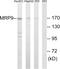 ATP Binding Cassette Subfamily C Member 12 antibody, GTX87007, GeneTex, Western Blot image 