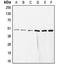 Glutamate receptor 4 antibody, orb214009, Biorbyt, Western Blot image 
