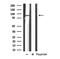 Exostosin Glycosyltransferase 1 antibody, GTX03280, GeneTex, Western Blot image 