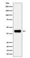 Acetyl-CoA Acyltransferase 2 antibody, M08341-1, Boster Biological Technology, Western Blot image 