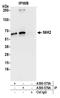 Ribosomal Protein S6 Kinase B2 antibody, A300-575A, Bethyl Labs, Immunoprecipitation image 