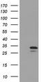 Uridine-Cytidine Kinase 1 antibody, LS-C115448, Lifespan Biosciences, Western Blot image 