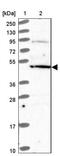 Diphthamide Biosynthesis 5 antibody, NBP2-13934, Novus Biologicals, Western Blot image 
