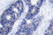 Insulin Receptor Substrate 1 antibody, AP20709PU-N, Origene, Immunohistochemistry paraffin image 