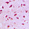 RAN Binding Protein 6 antibody, LS-C353389, Lifespan Biosciences, Immunohistochemistry paraffin image 