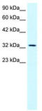 Small Nuclear RNA Activating Complex Polypeptide 2 antibody, TA330156, Origene, Western Blot image 