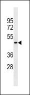 Peptidoglycan Recognition Protein 4 antibody, 59-936, ProSci, Western Blot image 