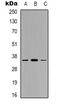 Gamma-Glutamyl Hydrolase antibody, abx133717, Abbexa, Western Blot image 