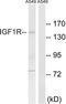 Insulin Like Growth Factor 1 Receptor antibody, TA311815, Origene, Western Blot image 