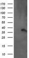 Armadillo Repeat Containing 1 antibody, TA505414AM, Origene, Western Blot image 