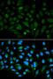 Decorin antibody, LS-C331624, Lifespan Biosciences, Immunofluorescence image 