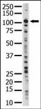 Serine/Threonine Kinase 31 antibody, AP13933PU-N, Origene, Western Blot image 