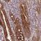 Leucine Rich Melanocyte Differentiation Associated antibody, NBP2-14802, Novus Biologicals, Immunohistochemistry paraffin image 