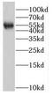 Membrane Palmitoylated Protein 1 antibody, FNab05287, FineTest, Western Blot image 