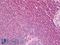 Phospholipase C Gamma 2 antibody, LS-B6989, Lifespan Biosciences, Immunohistochemistry paraffin image 