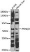 Ankyrin repeat and sterile alpha motif domain-containing protein 1B antibody, GTX64918, GeneTex, Western Blot image 