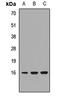 Proteasome Maturation Protein antibody, orb412844, Biorbyt, Western Blot image 