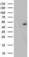 Casein Kinase 1 Gamma 2 antibody, TA802864S, Origene, Western Blot image 