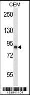 Calpain 11 antibody, 57-319, ProSci, Western Blot image 