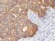 Keratin 8 antibody, V2663IHC-7ML, NSJ Bioreagents, Immunohistochemistry paraffin image 