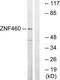 Zinc Finger Protein 460 antibody, TA315104, Origene, Western Blot image 