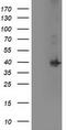 Microtubule-associated protein RP/EB family member 2 antibody, TA502873S, Origene, Western Blot image 