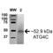 Autophagy Related 4C Cysteine Peptidase antibody, SPC-633D-A700, StressMarq, Western Blot image 