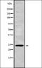 Coagulation Factor XIII B Chain antibody, orb338197, Biorbyt, Western Blot image 