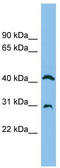 ADA1 antibody, TA339930, Origene, Western Blot image 