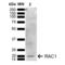 Ras-related C3 botulinum toxin substrate 1 antibody, LS-C776253, Lifespan Biosciences, Western Blot image 
