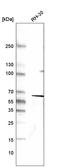 Desmin antibody, AMAb91303, Atlas Antibodies, Western Blot image 