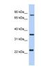 Putative uncharacterized protein C17orf82 antibody, NBP1-56810, Novus Biologicals, Western Blot image 