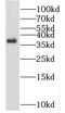 NK2 Homeobox 5 antibody, FNab05751, FineTest, Western Blot image 