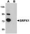Sushi Repeat Containing Protein X-Linked antibody, NBP1-77086, Novus Biologicals, Western Blot image 