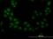 Serine/Threonine Kinase 38 antibody, H00011329-M11, Novus Biologicals, Immunocytochemistry image 