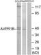 Arginine Vasopressin Receptor 1B antibody, TA311798, Origene, Western Blot image 