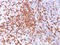 Hyaluronate receptor antibody, AM50194PU-S, Origene, Immunohistochemistry frozen image 