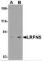 Leucine Rich Repeat And Fibronectin Type III Domain Containing 5 antibody, 5079, ProSci, Western Blot image 